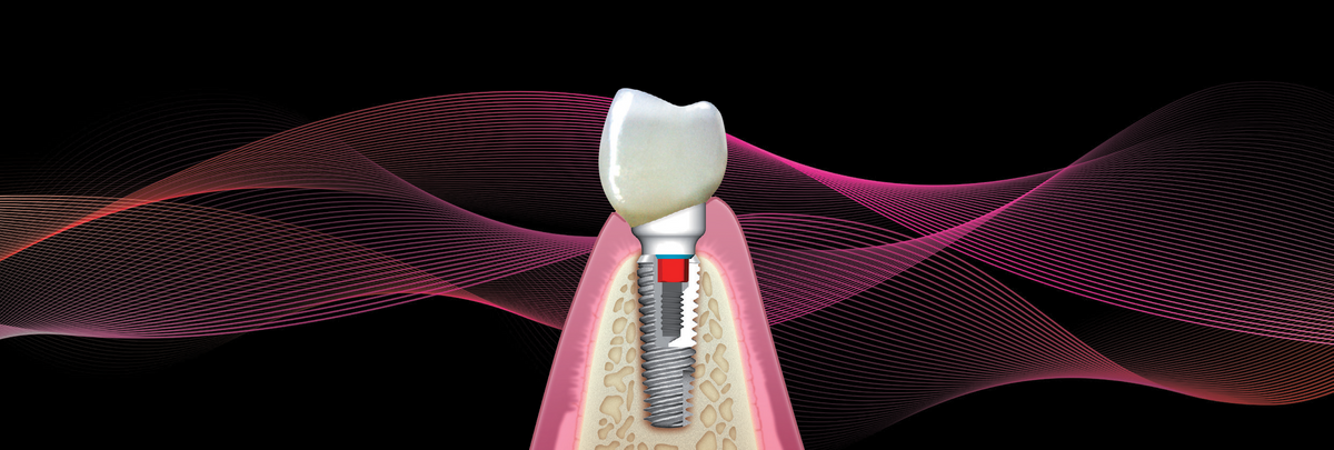 TRI Dental ANZ Web Shop – TRI DENTAL ANZ - WEBSTORE